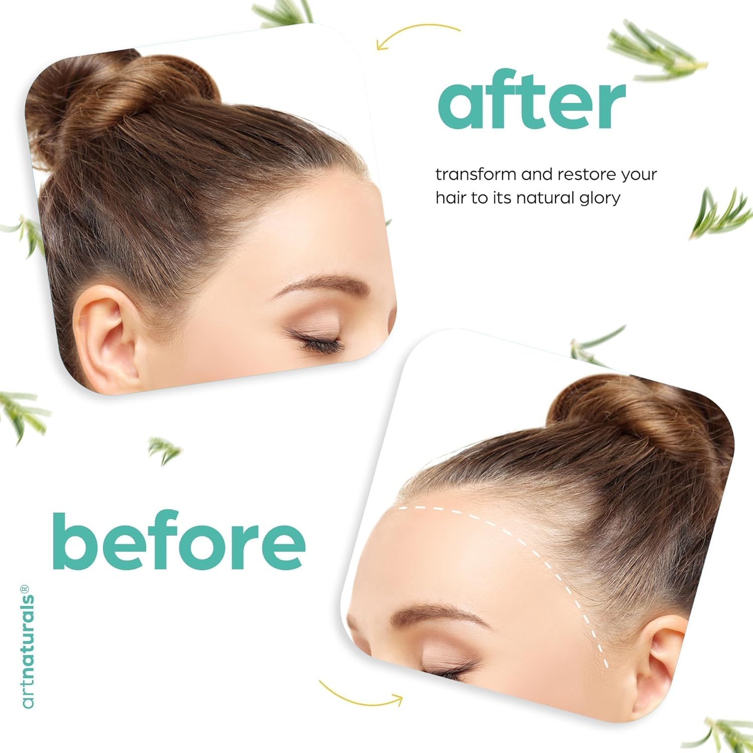 ArtNaturals Organic Rosemary & Castor Hair Growth Oil + Scalp Massager Set – Hair Relaxer for Dry, Itchy Scalp, Thickening & Hydration - Scalp Oil Products For Damaged Hair & Split Ends – 4.0 oz - Image 7