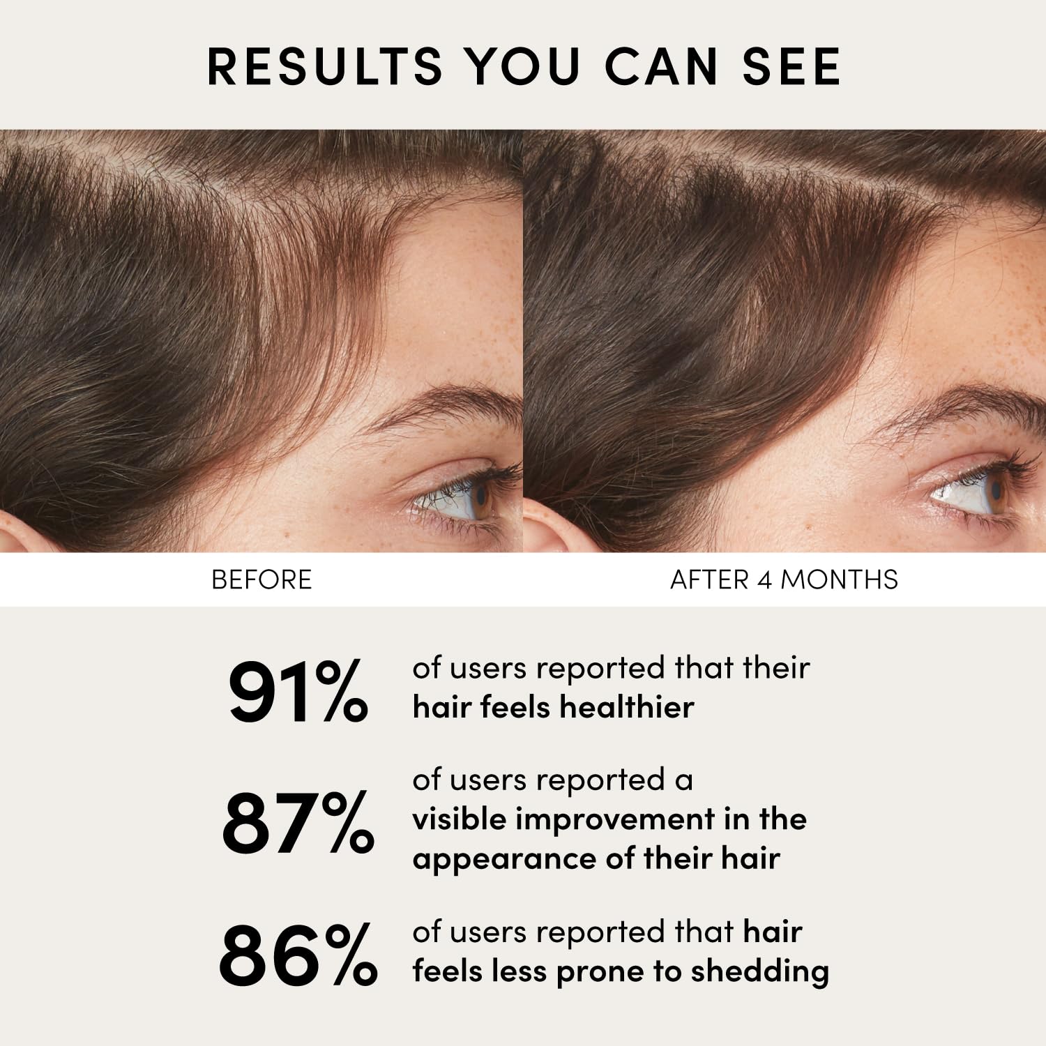 OUAI Scalp Serum - Balancing Hair Serum with Red Clover Extract, Siberian Ginseng and Peptides for Thicker and Fuller-Looking Hair - Paraben, Phthalate and Sulfate Free Scalp Care (2 Fl Oz) - Image 6